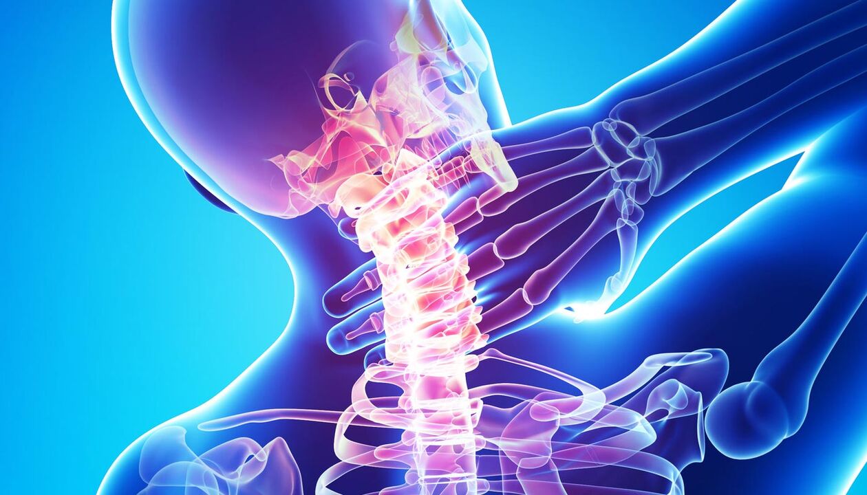 bol u vratu zbog osteohondroze